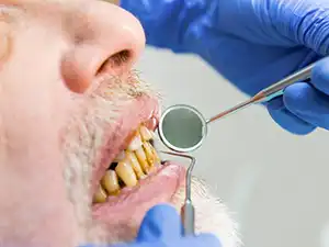 Periodontal Treatment